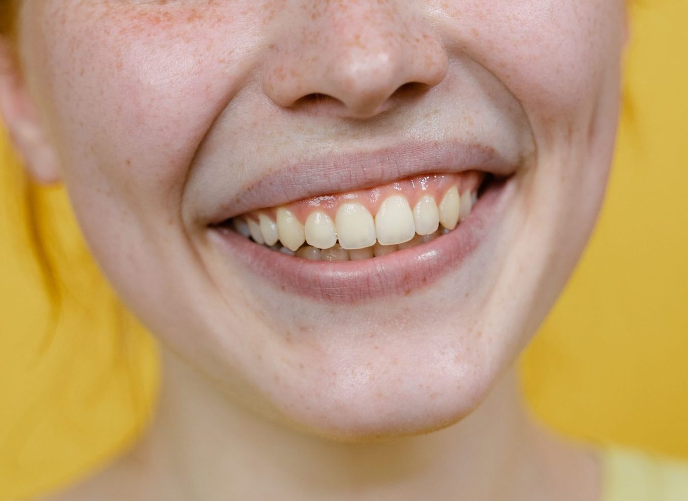 sourire